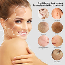Load image into Gallery viewer, Dark Spot Remover for Face and Body, Dark Spot Corrector, Age Spots Cream and Freckle Remover- Formulated with Arbutin, Niacinamide & Vitamin E-60 ml