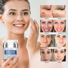 Load image into Gallery viewer, Dark Spot Remover for Face and Body, Dark Spot Corrector, Age Spots Cream and Freckle Remover- Formulated with Arbutin, Niacinamide & Vitamin E-60 ml