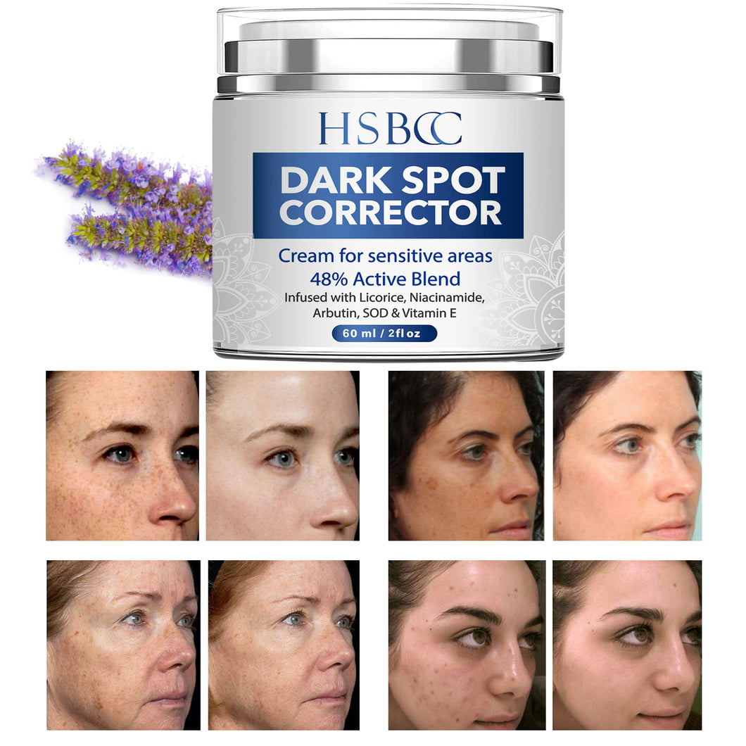 Dark Spot Remover for Face and Body, Dark Spot Corrector, Age Spots Cream and Freckle Remover- Formulated with Arbutin, Niacinamide & Vitamin E-60 ml